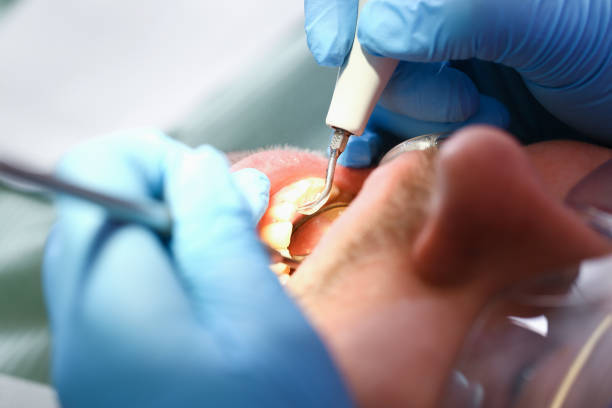 Best Emergency Treatment for Jaw Pain or Injury in San Carlos, AZ