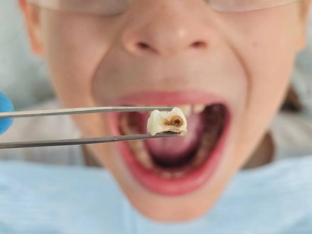 Best Emergency Pediatric Dental Care in San Carlos, AZ